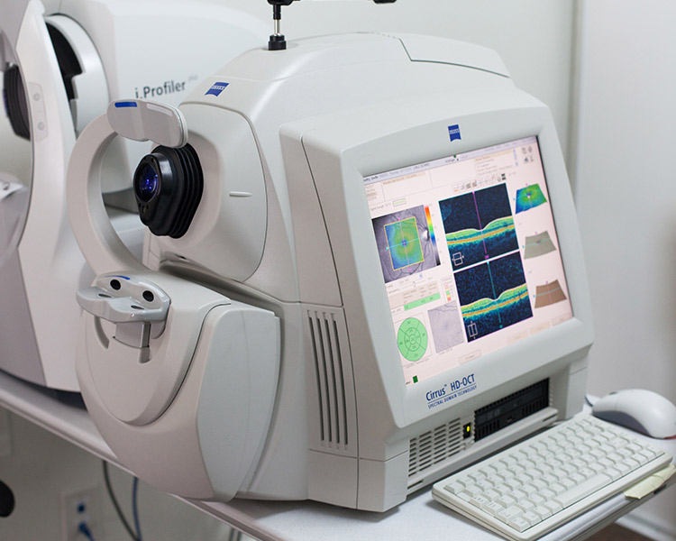 Optical Coherence Tomography